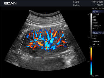 Edan Acclarix AX3 Compact Color Doppler Ultrasound System - Ultrasound System | CincyMed