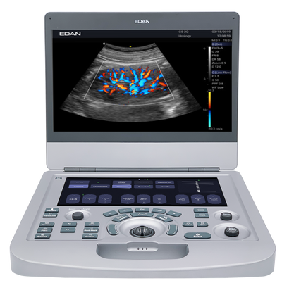Edan Acclarix AX2 Compact Color Doppler Ultrasound System
