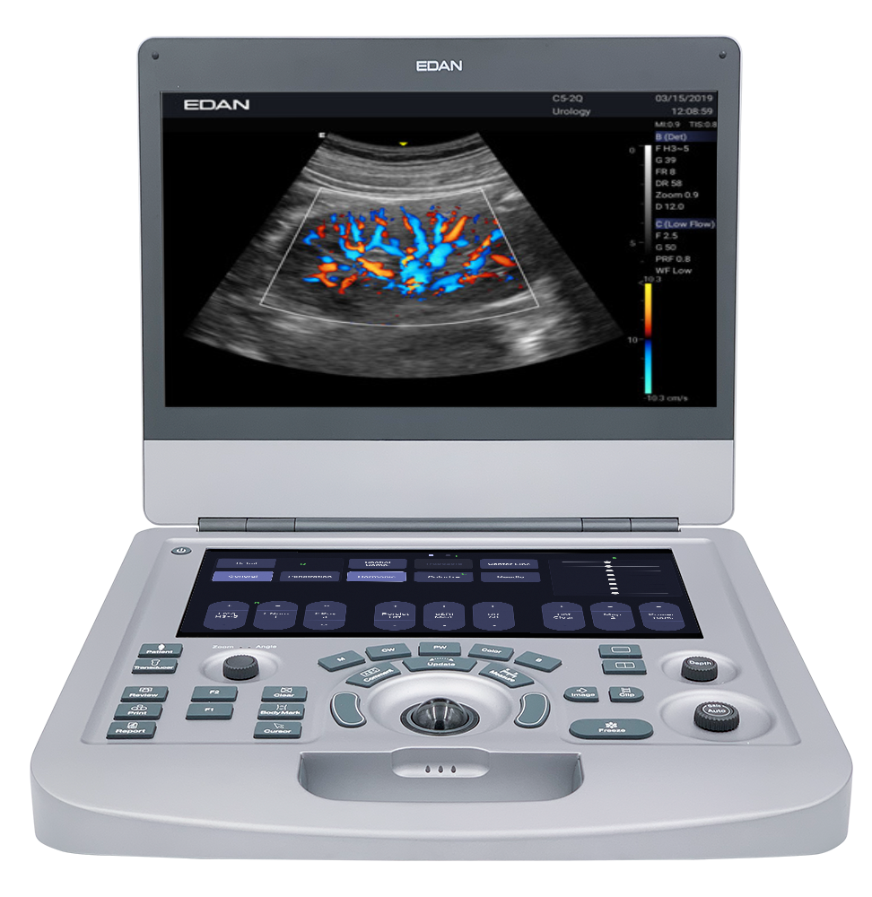 Edan Acclarix AX3 Compact Color Doppler Ultrasound System - Ultrasound System | CincyMed