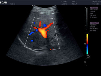 Edan Acclarix AX8 Ultrasound Machine - Ultrasound System | CincyMed