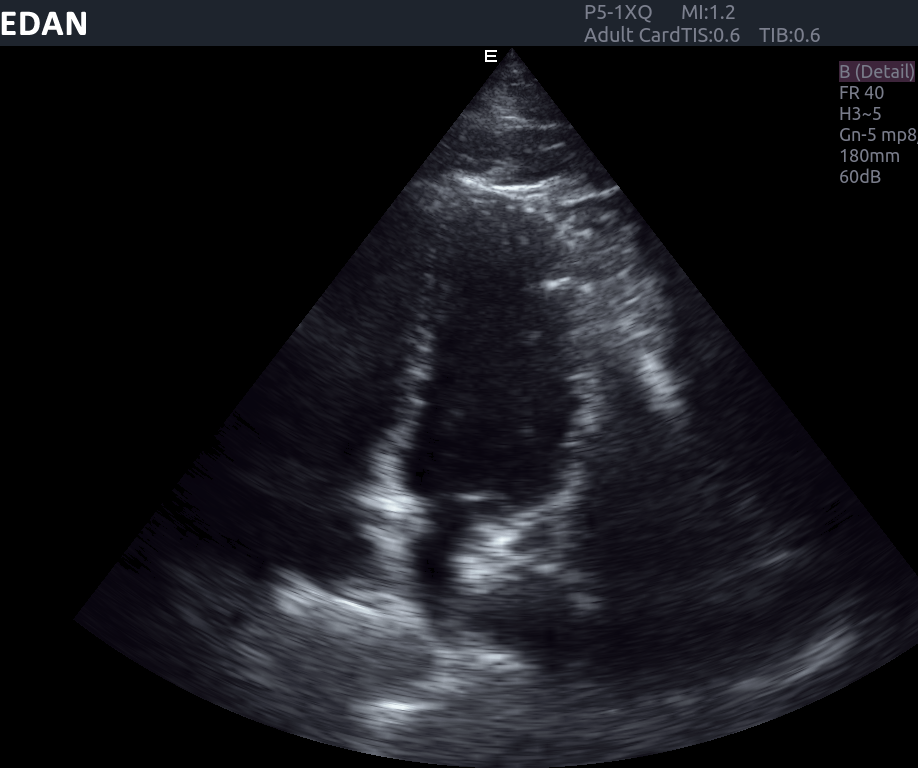 Edan Acclarix AX8 Ultrasound Machine - Ultrasound System | CincyMed
