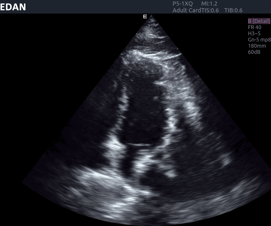 Edan Acclarix AX8 Ultrasound Machine - Ultrasound System | CincyMed