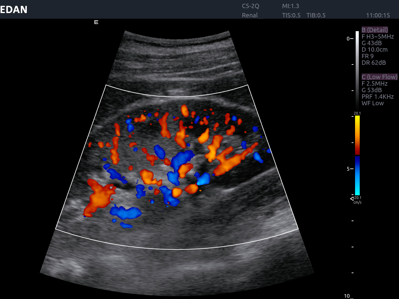 Edan Acclarix AX8 Ultrasound Machine - Ultrasound System | CincyMed
