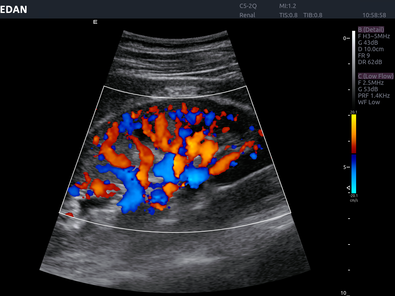 Edan Acclarix AX8 Ultrasound Machine - Ultrasound System | CincyMed