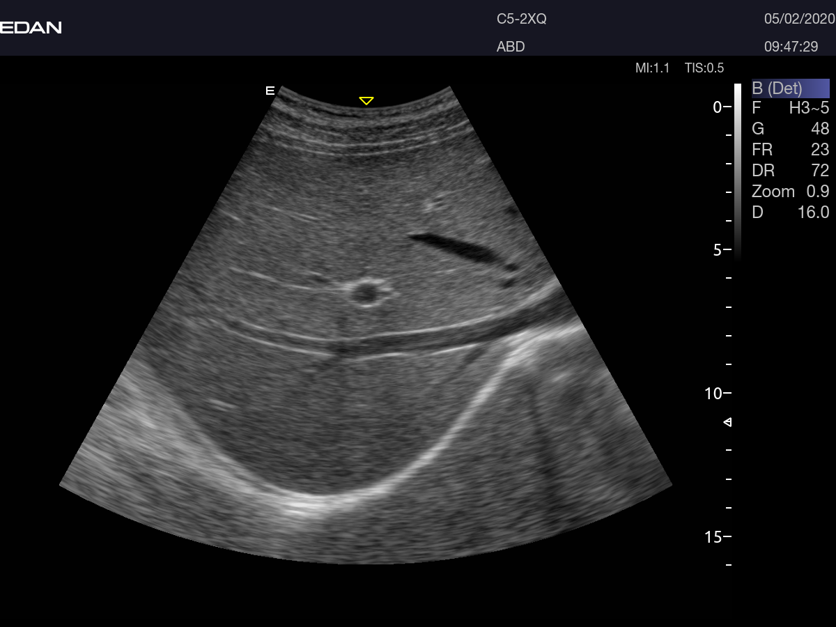 Edan Acclarix AX8 Ultrasound Machine - Ultrasound System | CincyMed