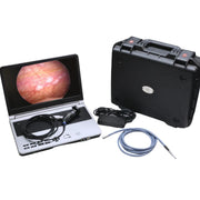 EndoPro Master Series Endoscopic Video Camera System | EP2030HD - Cystoscope | CincyMed