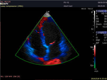 LX9 Diagnostic Ultrasound Machine - Ultrasound System | CincyMed
