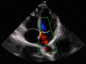 LX9 Diagnostic Ultrasound Machine - Ultrasound System | CincyMed