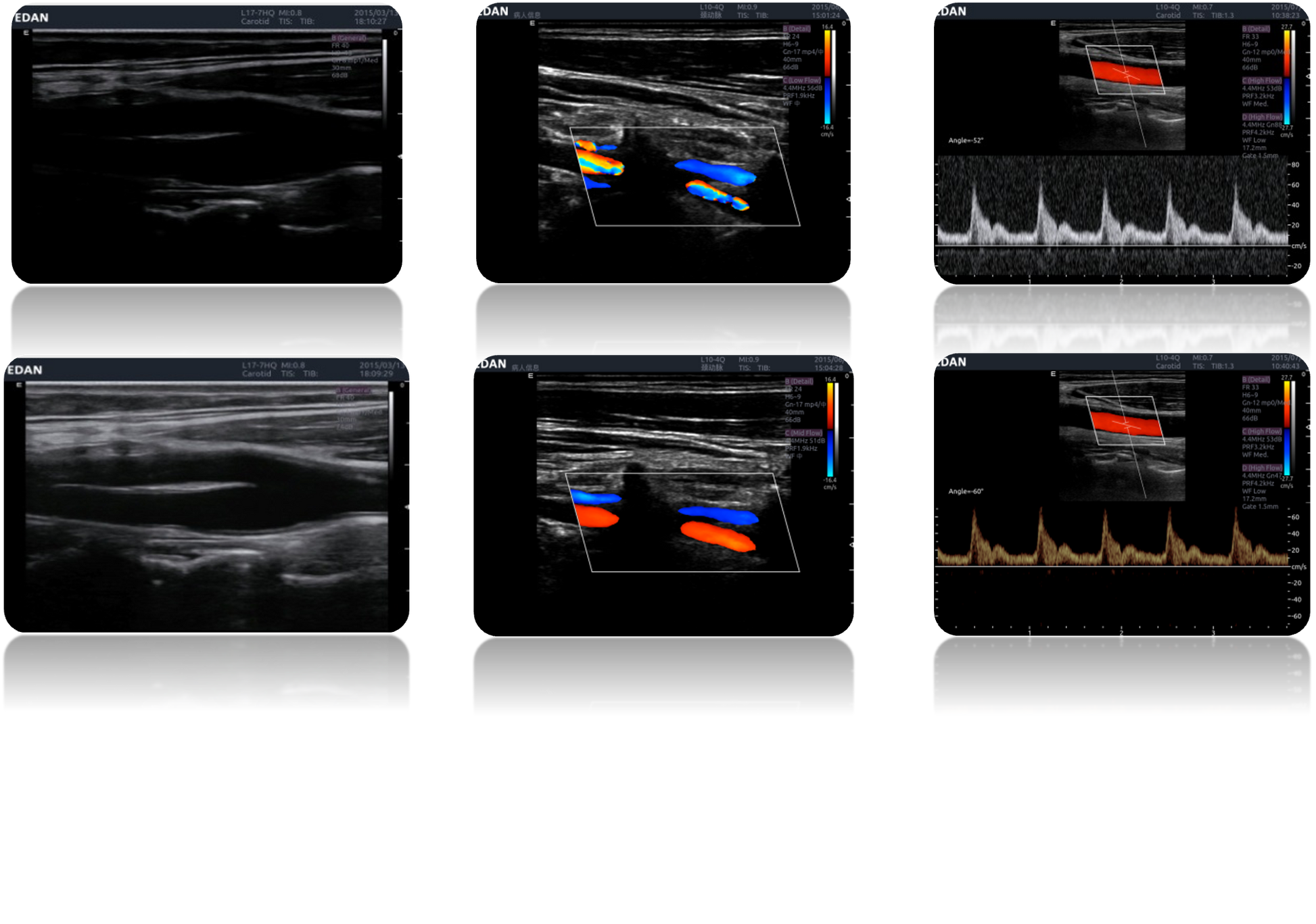 LX9 Diagnostic Ultrasound Machine - Ultrasound System | CincyMed