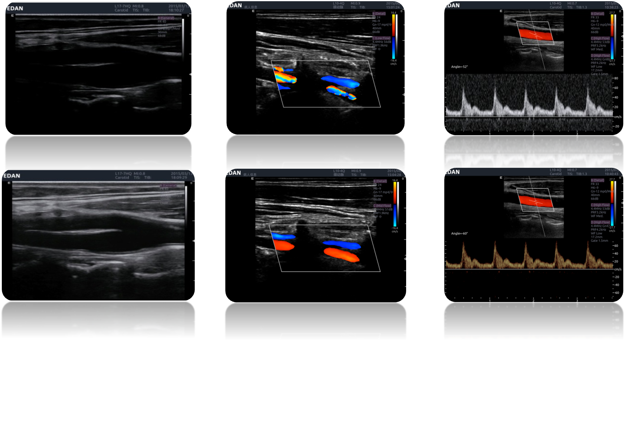 LX9 Diagnostic Ultrasound Machine - Ultrasound System | CincyMed