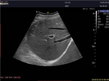 LX9 Diagnostic Ultrasound Machine - Ultrasound System | CincyMed