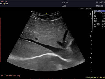 LX9 Diagnostic Ultrasound Machine - Ultrasound System | CincyMed