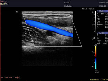LX9 Diagnostic Ultrasound Machine - Ultrasound System | CincyMed