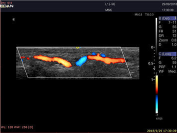 LX9 Diagnostic Ultrasound Machine - Ultrasound System | CincyMed