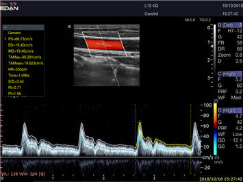 LX9 Diagnostic Ultrasound Machine - Ultrasound System | CincyMed